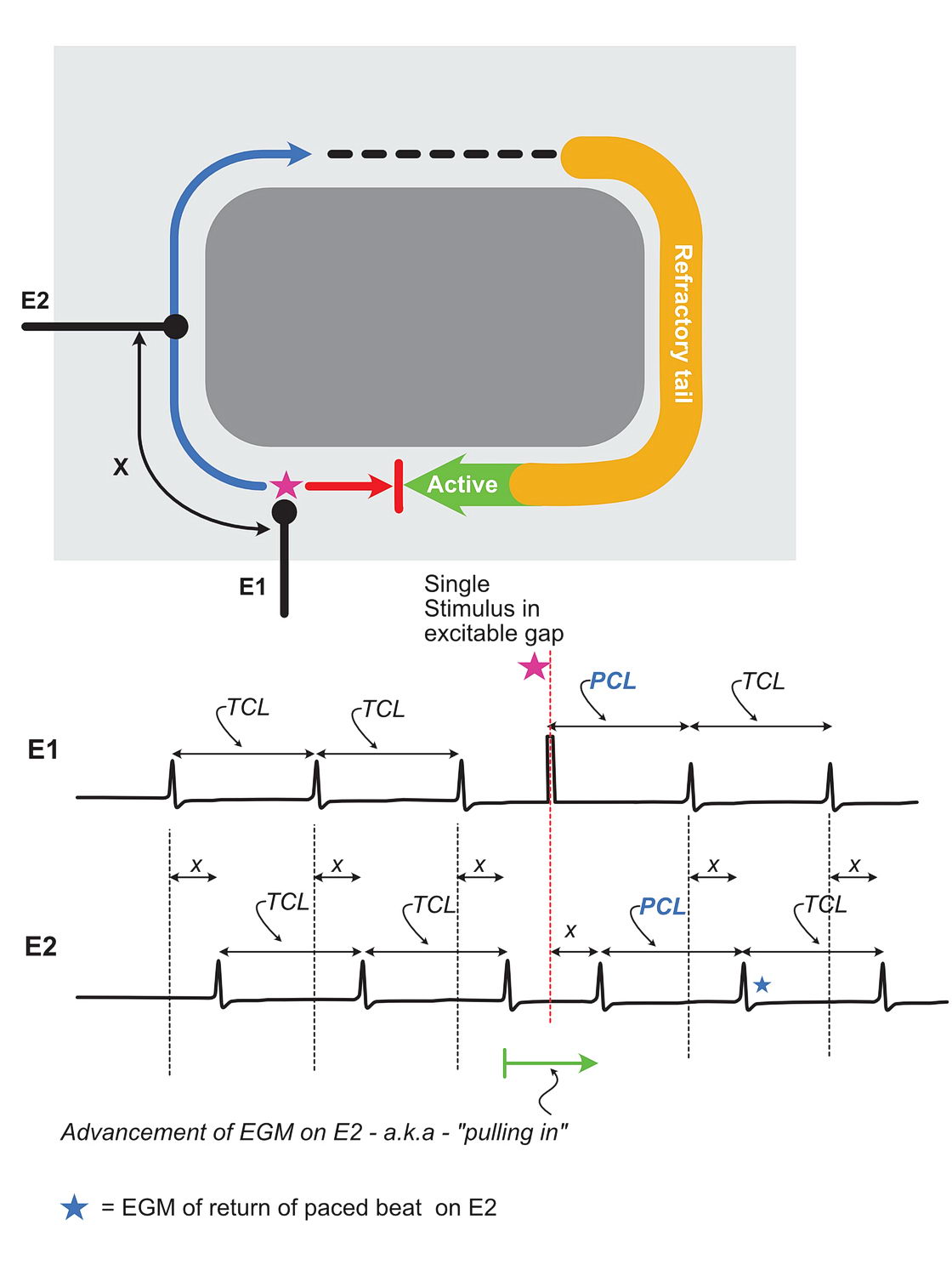 Entrainment of a re-entrant circuit with a single pace inside the circuit and changes observed in sequential electrodes