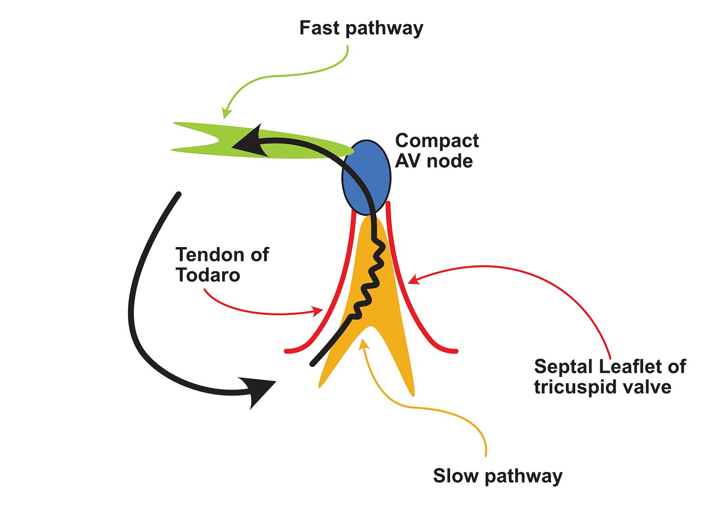 Re-entrant circuits - basic circuit of AV nodal re-entry